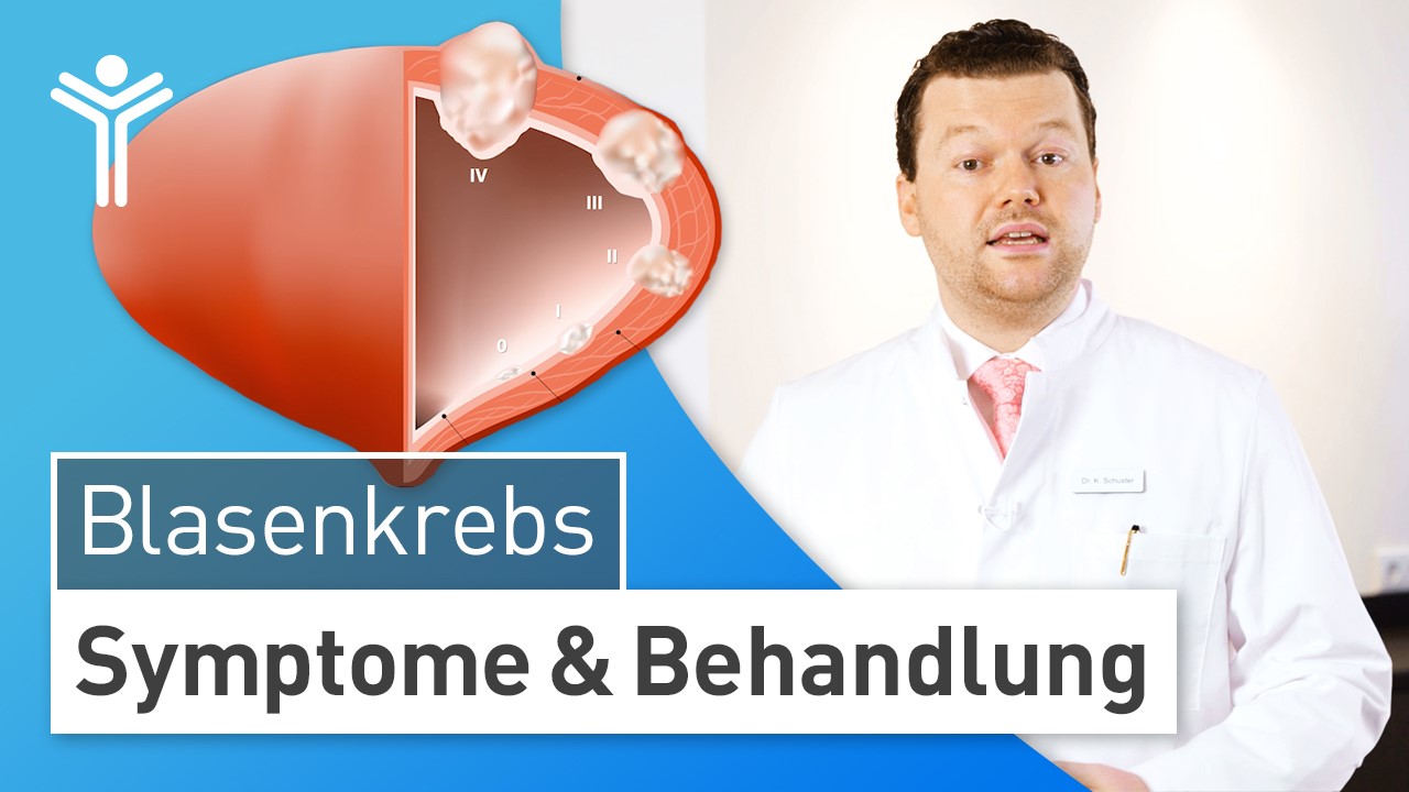 Blasenkrebs - Symptome & Behandlung