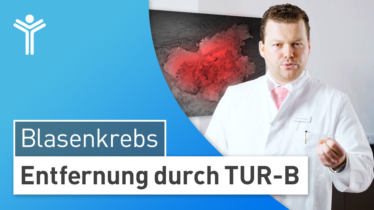 Blasenkrebs - Entfernung durch TUR-B