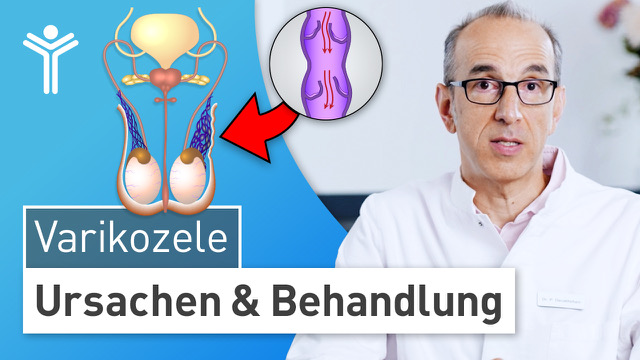 Varikozele - Ursachen & Behandlung